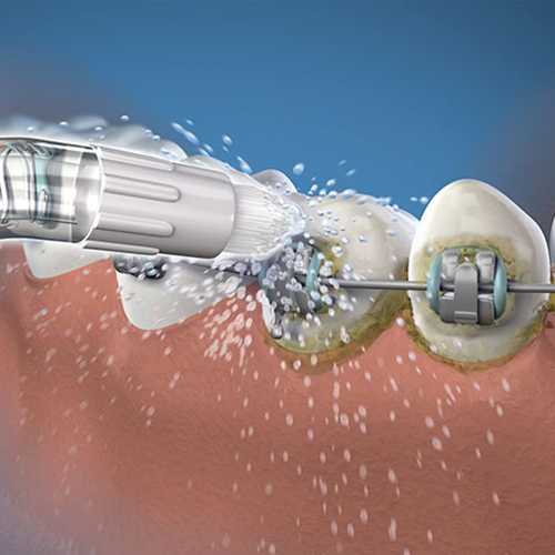od-100-ortodontic-waterpik-action-500x500-1
